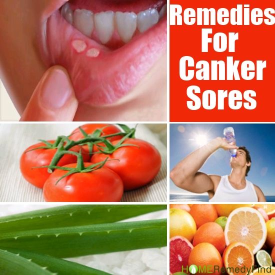 tomatoe for sores FabWoman News, Style, Living Content For The