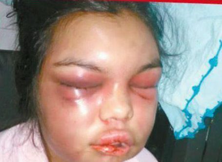 Jealous Husband Brutalizes Wife