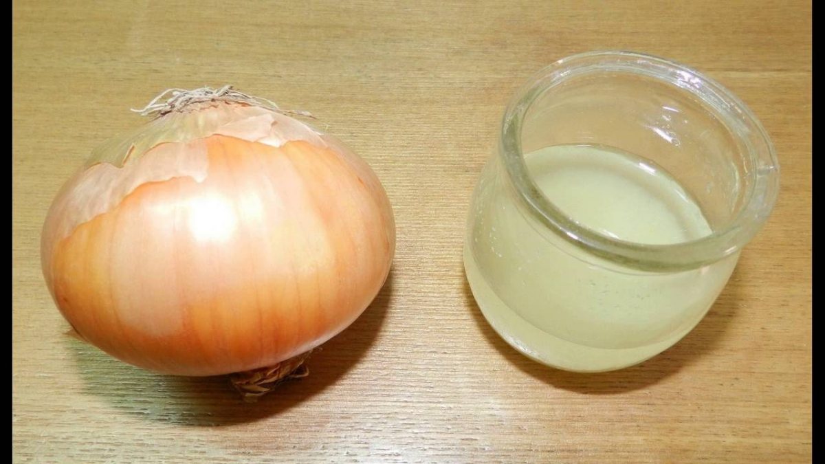 How To Use Onion Juice For Dandruff FabWoman