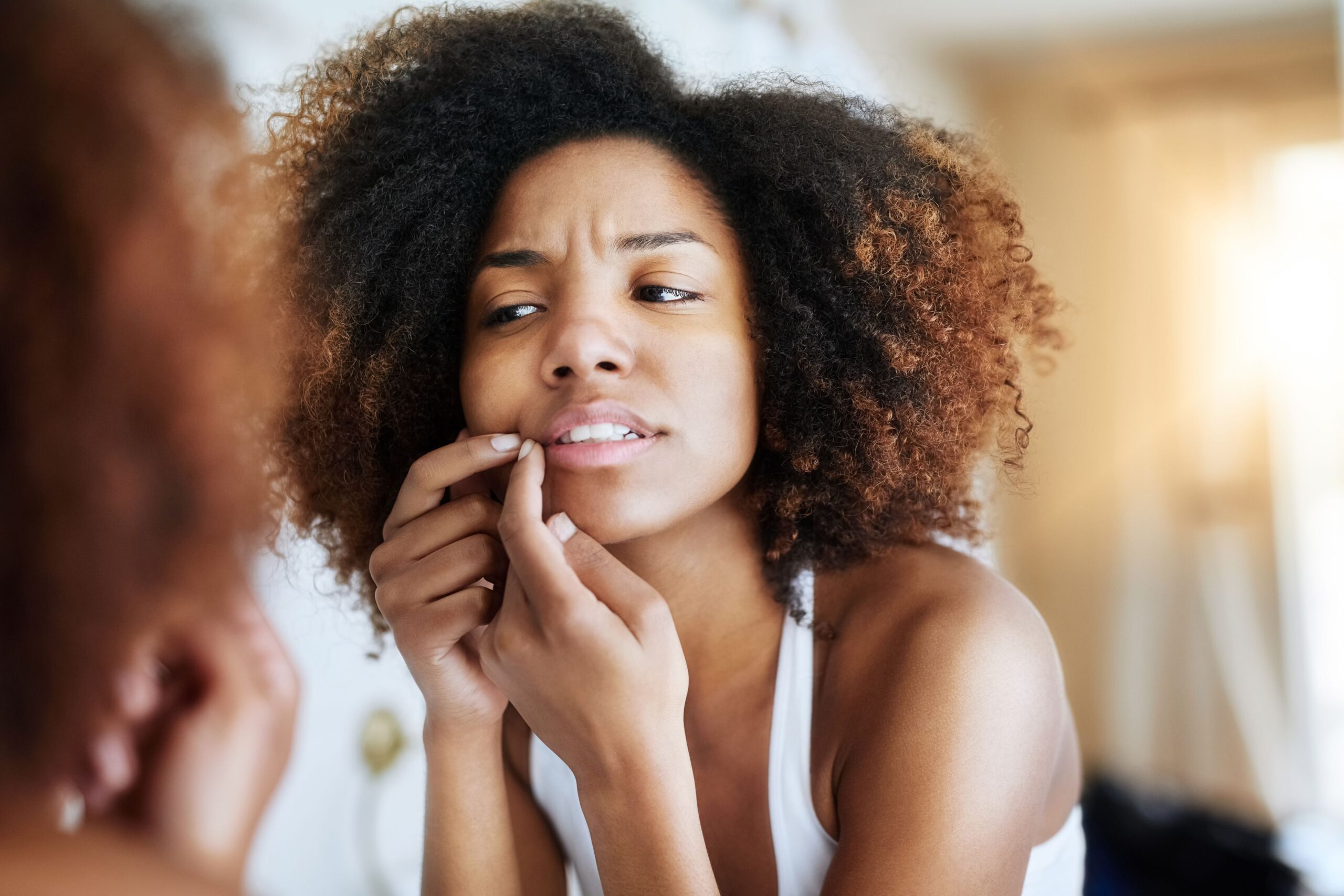 tea tree oil acne treatment