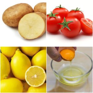 white heads home remedies