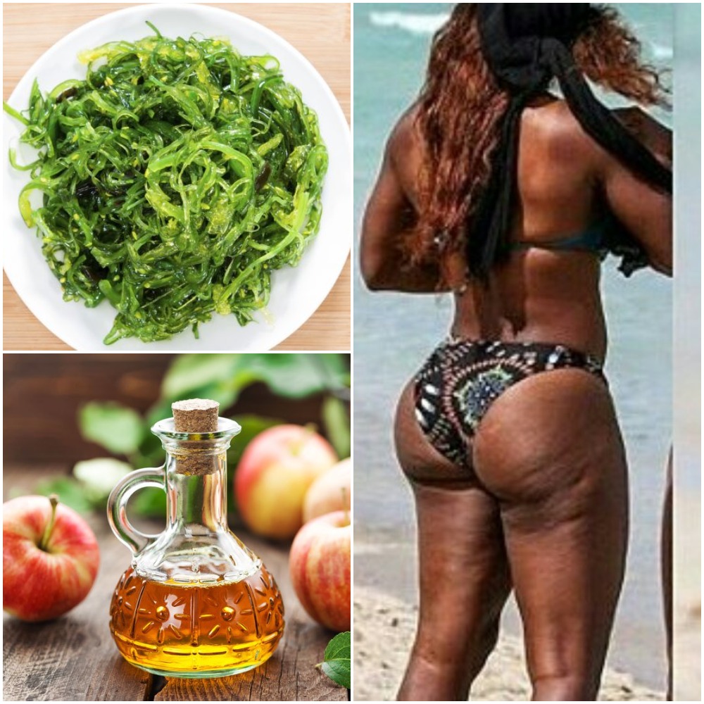 Cellulite Home Remedies
