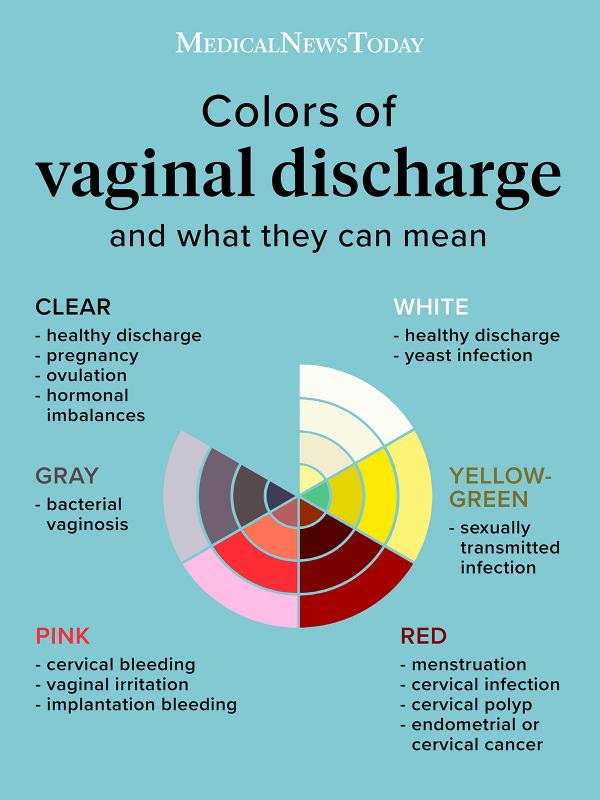 Colours-Of-Vaginal-Discharge-Infographic - Fabwoman  News -8197