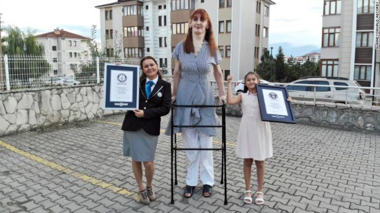 Guinness World Records Declares 24 Year Old Turkish Woman As World S Tallest Living Woman