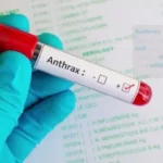 anthrax outbreak in nigeria