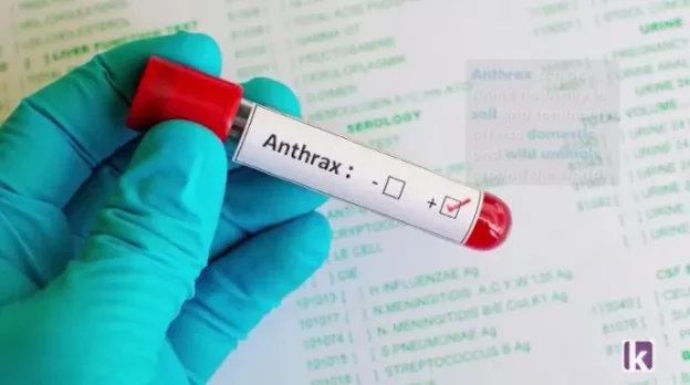 anthrax outbreak in nigeria