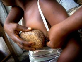 breast ironing