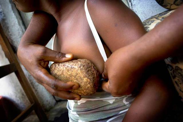breast ironing
