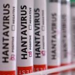 Hantavirus