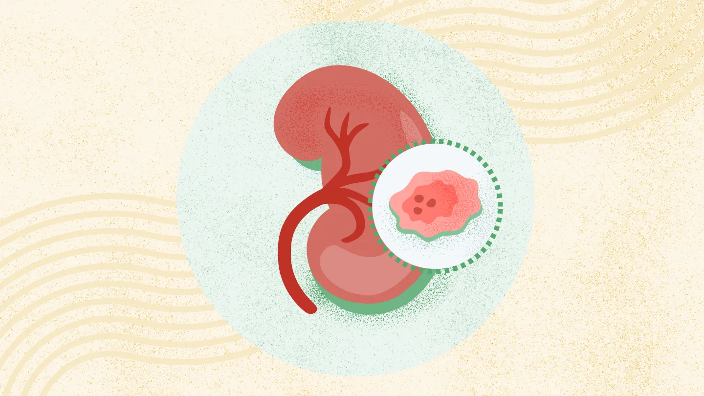 Kidney Cancer