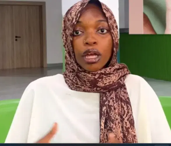 Nigerian Woman Born With Fingerprints
