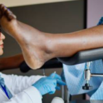 Pap Smear